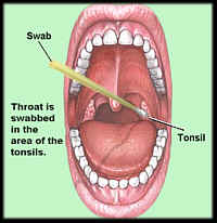 How To Do A Throat Swab 11